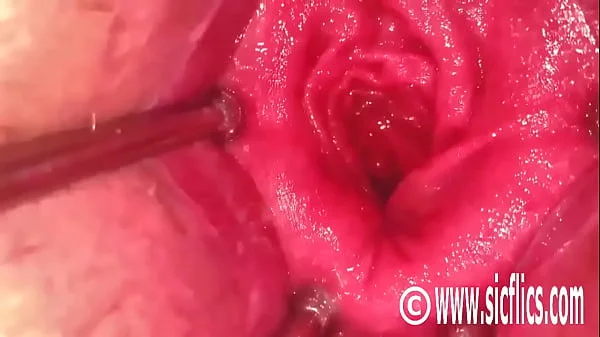 Fisting Her Speculum Gaping Ass