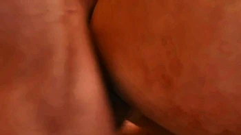 Under The Knife - Episode 2